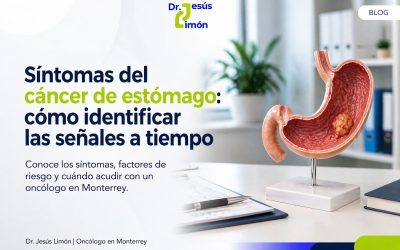 Síntomas del cáncer de estómago: cómo identificar las señales a tiempo