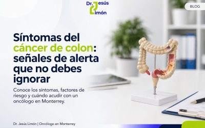 Síntomas del cáncer de colon: señales de alerta que no debes ignorar
